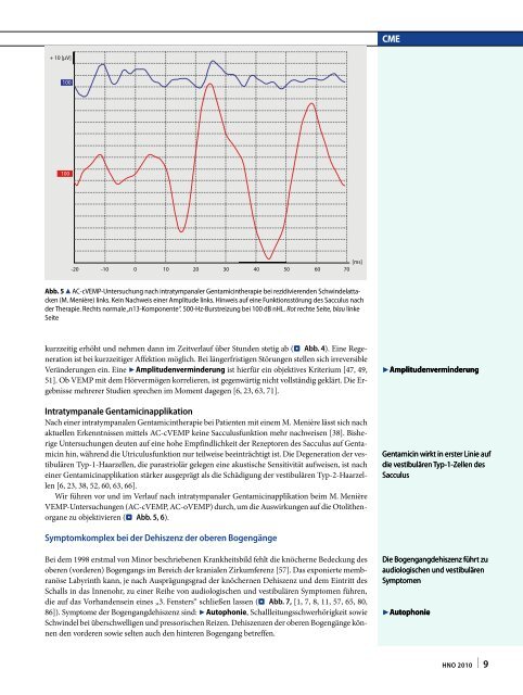 Die Ableitung zervikaler und okulärer vestibulär evozierter ...