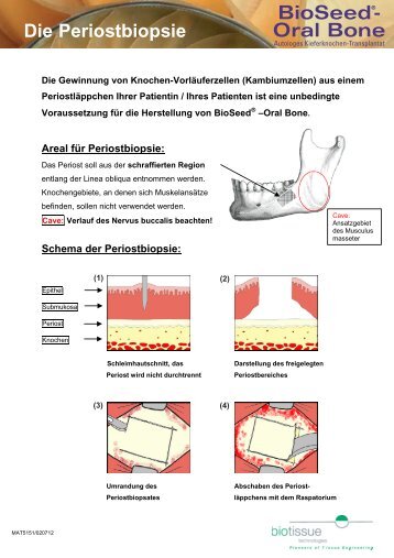 Die Periostbiopsie