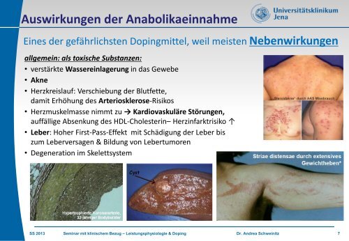 Leistung / Doping