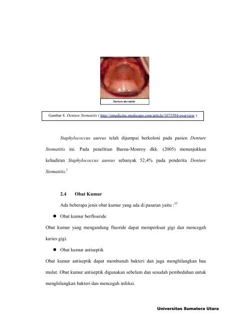 Chapter II.pdf - USU Institutional Repository - Universitas Sumatera ...