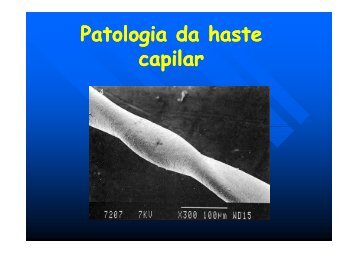 Patologia da haste capilar - Espaço de Erika Liz