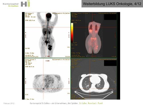 Thomas Cerny Kantonsspital St.Gallen thomas.cerny@kssg.ch www ...