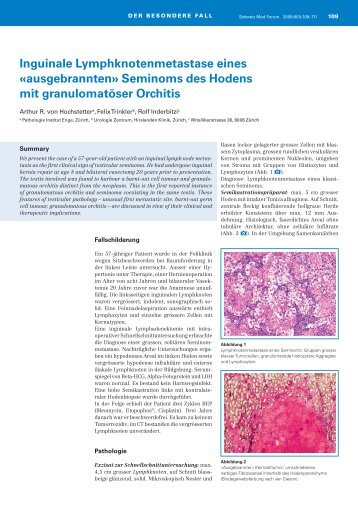 Inguinale LK-Metastase eines ausgebrannten - Pathologie Institut ...