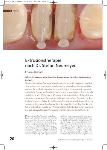 Extrusionstherapie nach Dr. Stefan Neumeyer - Zahnarztpraxis ...