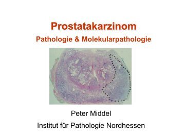 PCA - Pathologie Nordhessen