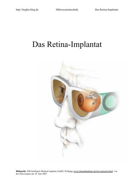 Das Retina-Implantat - Blog.de
