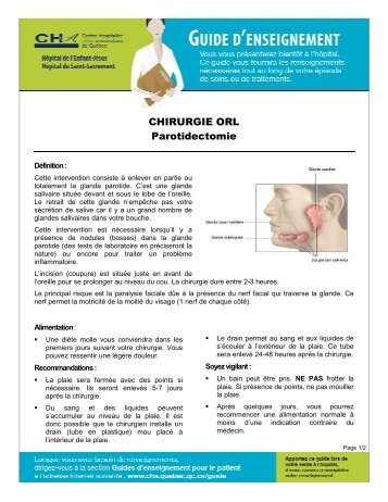 Parotidectomie VF