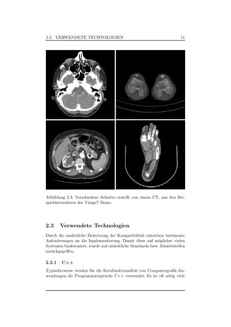 Download - Benjamin Granzow Portfolio