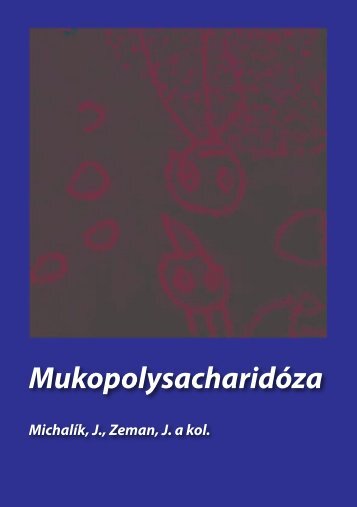 Mukopolysacharidóza - Speciální vzdělávací potřeby dětí a žáků se ...