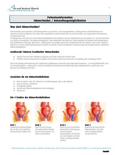 Hämorrhoiden Patienteninformation