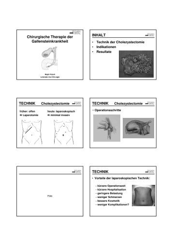 Gallensteine - gastroenterology-hepatology-basel