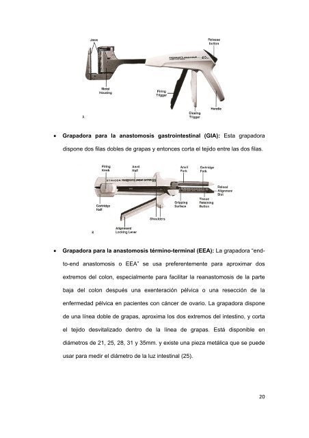 Exenteración pélvica en Ginecología Oncológica: 12 ... - Recercat