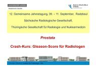 Prostata Crash-Kurs: Gleason-Score für Radiologen - Dank