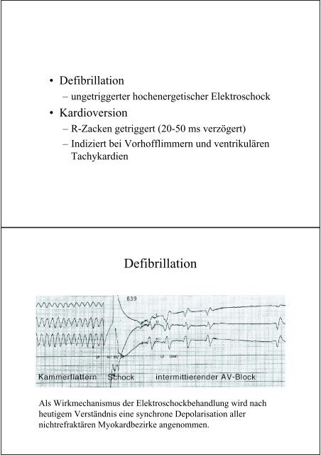 Defibrillator/Kardioverter