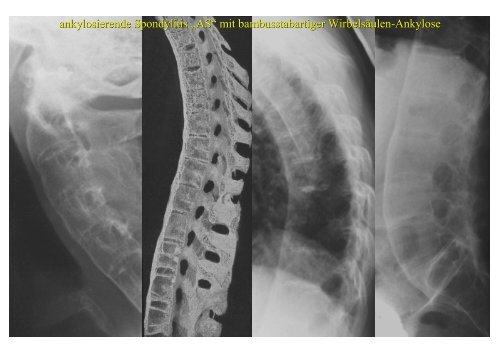 Download PowerPoint-Präsentation - Institut für Radiologie ...