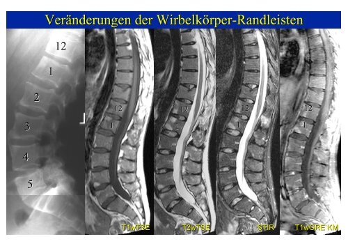 Download PowerPoint-Präsentation - Institut für Radiologie ...