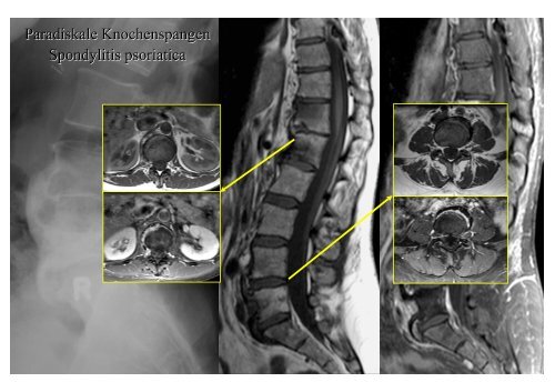 Download PowerPoint-Präsentation - Institut für Radiologie ...