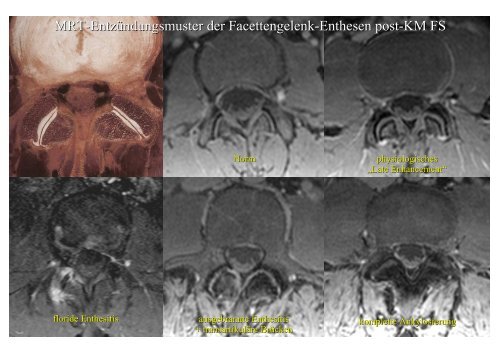 Download PowerPoint-Präsentation - Institut für Radiologie ...