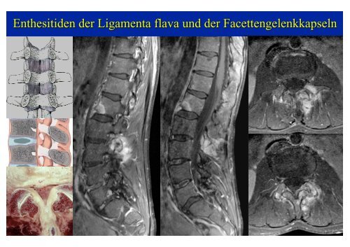 Download PowerPoint-Präsentation - Institut für Radiologie ...