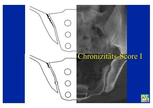 Download PowerPoint-Präsentation - Institut für Radiologie ...