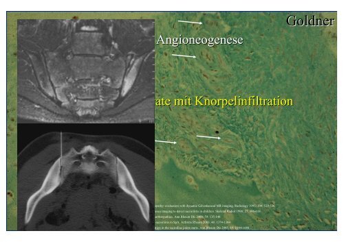 Download PowerPoint-Präsentation - Institut für Radiologie ...