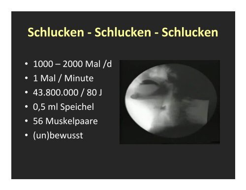 7 Diagnostik Dysphagie WIRTH 1 - NutriNews