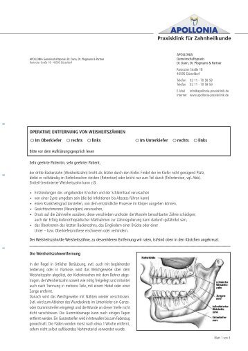 Information Weisheitszähne - Apollonia