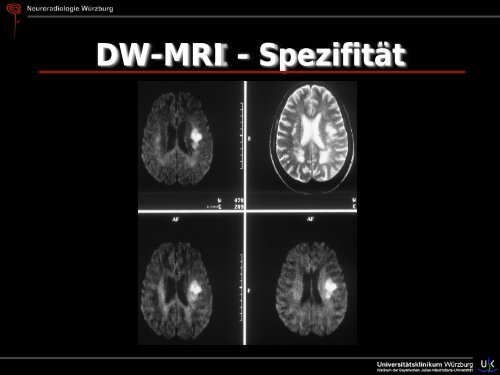 Schlaganfall - Abteilung für Neuroradiologie