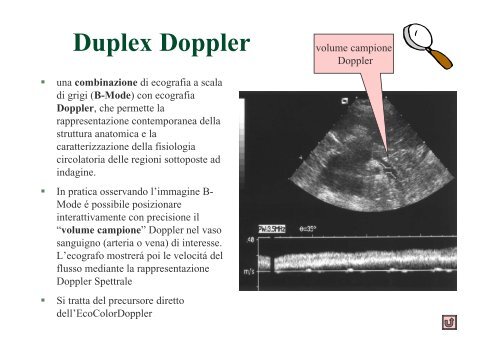 Vi racconto la storia del Doppler: dal B dimensionale al Color ...