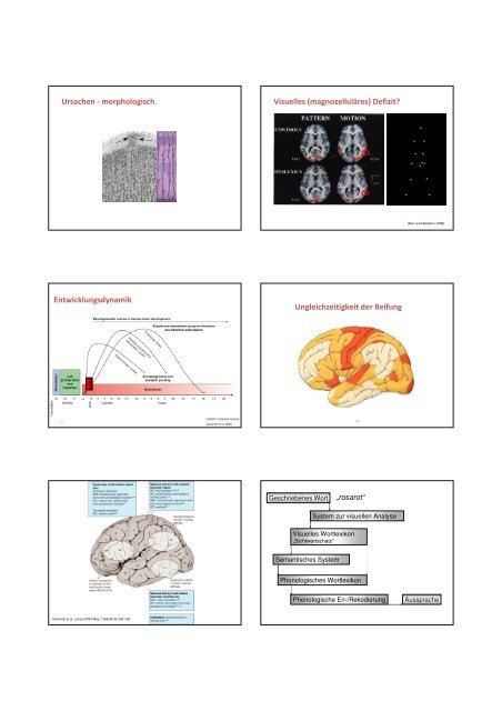 Zur Neuropsychologie von Dyslexie, AD(H)S und Dyskalkulie - SDBB