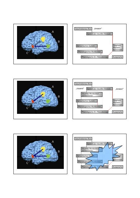 Zur Neuropsychologie von Dyslexie, AD(H)S und Dyskalkulie - SDBB