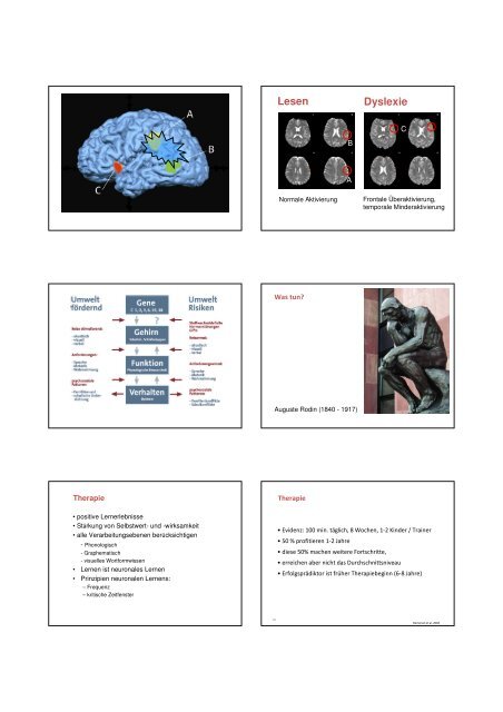 Zur Neuropsychologie von Dyslexie, AD(H)S und Dyskalkulie - SDBB