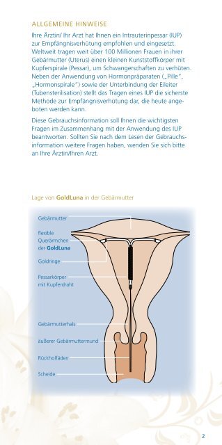 gebrauchs information für die anwenderin - Intrauterinpessar zur ...