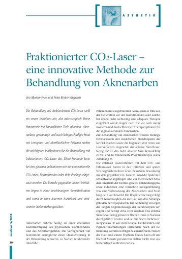 Fraktionierter CO2-Laser - Laserzentrum Zürichsee