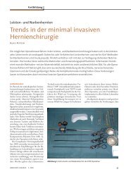 Trends in der minimal invasiven Hernienchirurgie - und ...