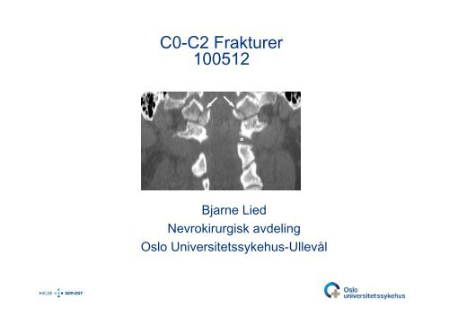 Bjarne Lied: C0-C2-frakturer - Oslo universitetssykehus