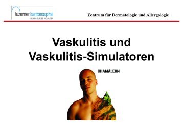 Vaskulitis und Vaskulitis-Simulatoren