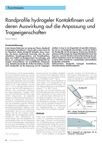 Randprofile hydrogeler Kontaktlinsen und deren Auswirkung auf die ...