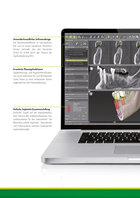 straumann® cares® guided surgery EINE FLEXIBLE ...