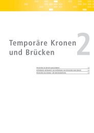 Temporäre Kronen und Brücken - Kerrdental.de