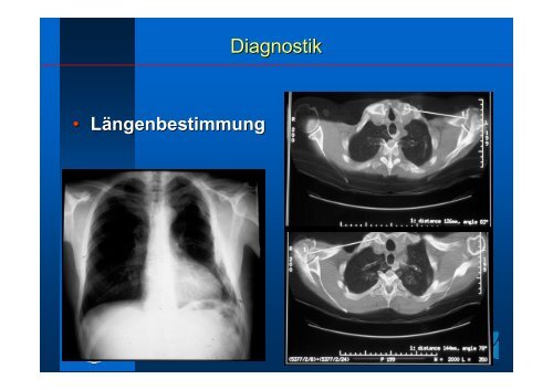 Frakturen obere Extremität PD Dr. Thomas Mückley - Klinik für Unfall ...