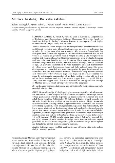 Menkes Hastaligi Cocuk Sagligi Ve Hastaliklari Dergisi
