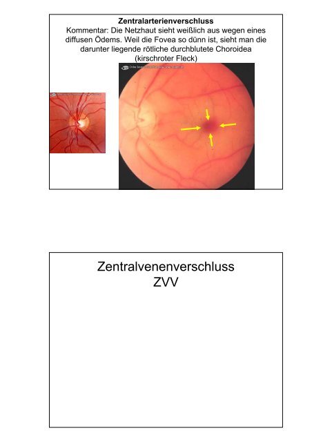 Notfälle Augenheilkunde