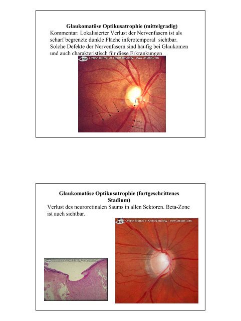 Notfälle Augenheilkunde