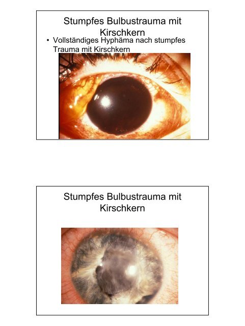 Notfälle Augenheilkunde