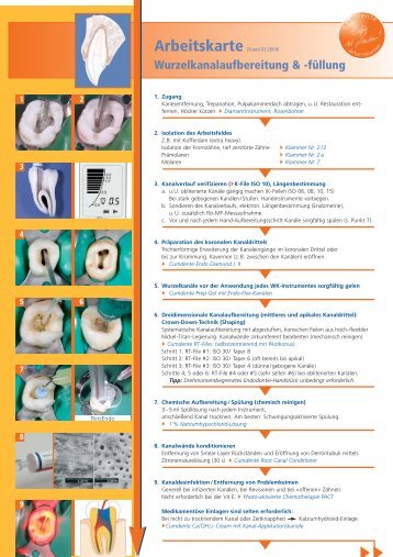 Arbeitskarte - Wurzelkanalaufbereitung und - Zahnerhaltung ...