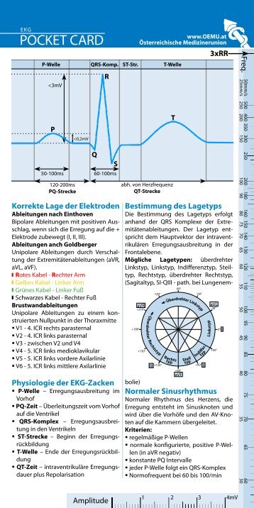 Pocketcard EKG - Österreichische Medizinerunion (ÖMU)