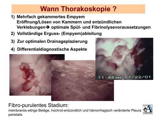 PDF 3,5 MB - Krankenhaus St. Elisabeth und St. Barbara Halle (Saale)