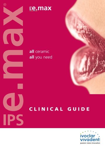 IPS e.max Clinical Guide - Ivoclar Vivadent