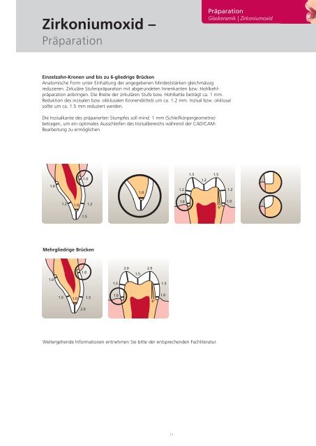 IPS e.max Clinical Guide - Ivoclar Vivadent